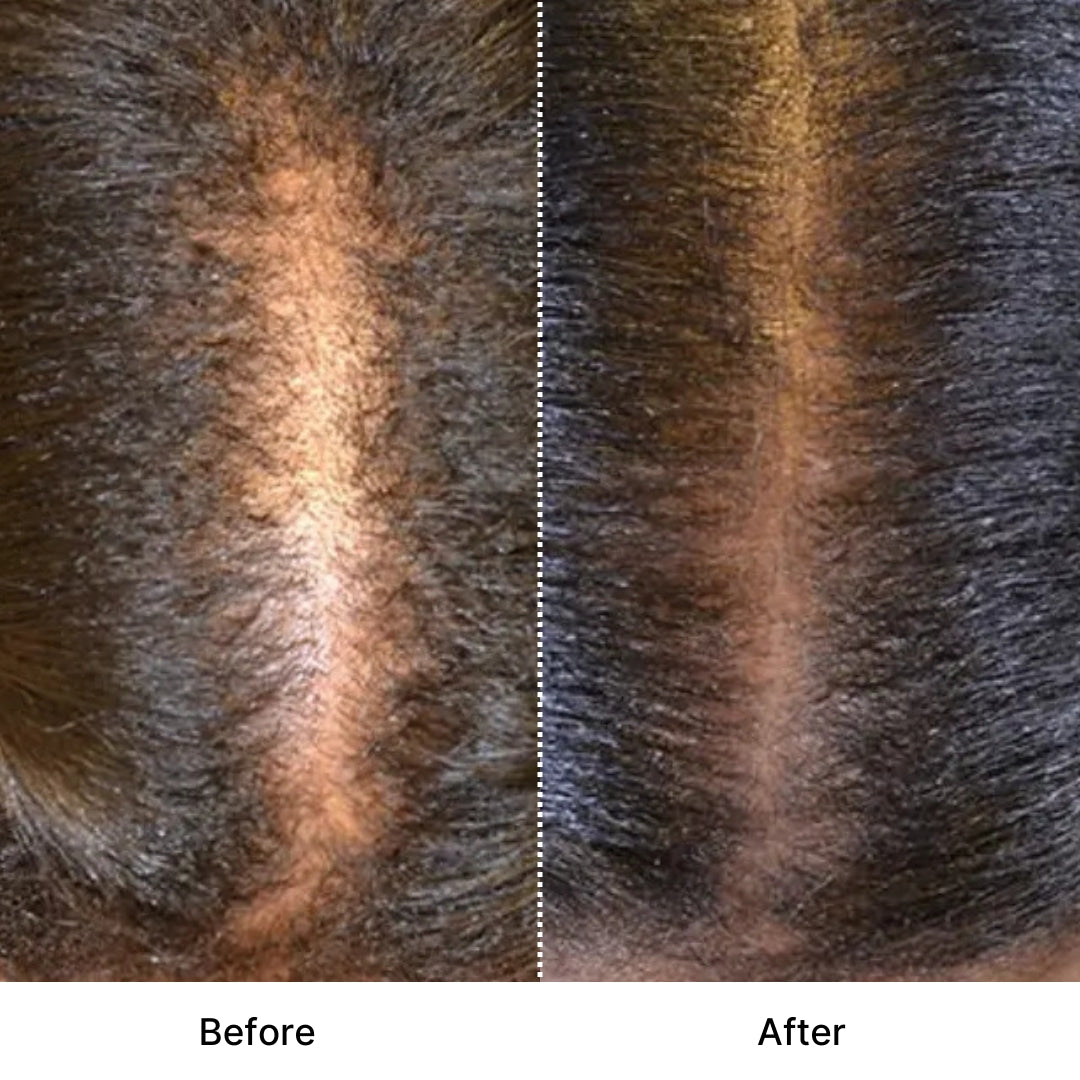 Hair Growth Accelerator Gummies